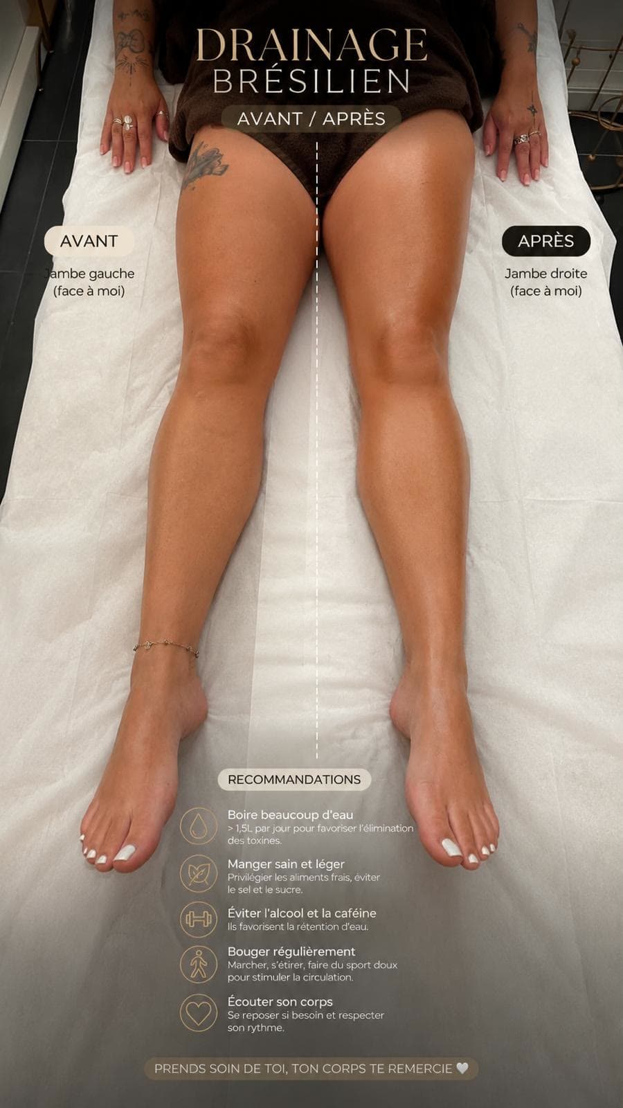 Comparaison avant et après drainage brésilien sur une jambe, et recommandations à suivre après la séance